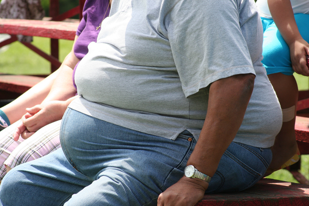 Favorecen la cirugía bariática para frenar la obesidad mórbida
