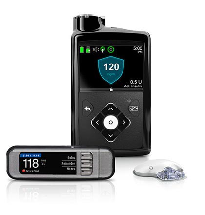Video: Crean microinfusora de insulina para pacientes con diabetes tipo 1